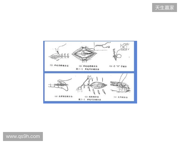 广州豹官方：杨浩眉弓伤口缝合30余针，预计5-7天后拆线